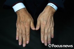 thumbimg